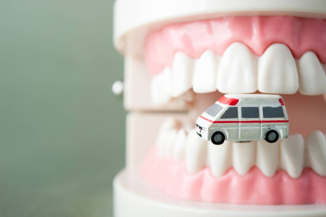 Dental emergency vehicle model positioned within a model mouth, showcasing teeth and gums.