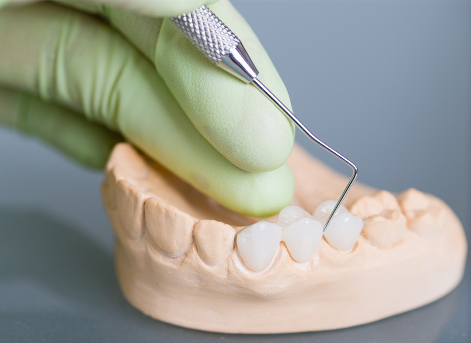 Dental technician using a tool to adjust porcelain dental crowns on a model of teeth.