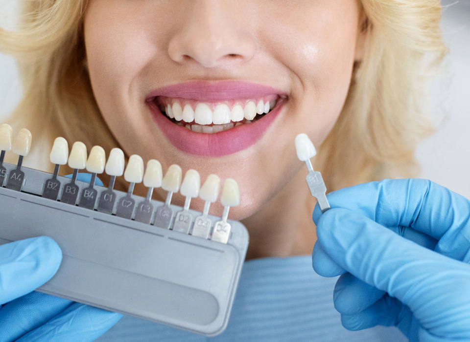 Teeth whitening shade chart being used to compare a patient's teeth to various shades.