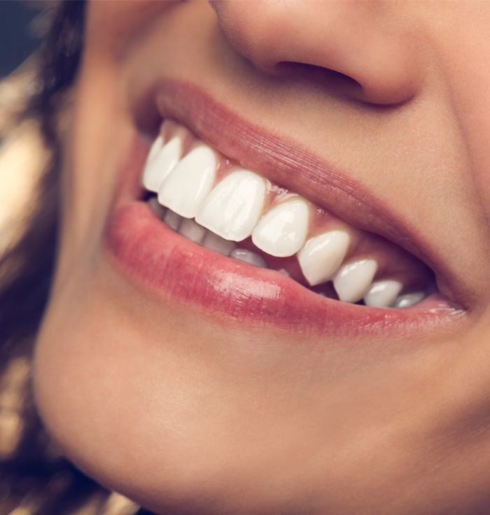 Close-up of a person's mouth showing a bright, healthy smile with even, white teeth.