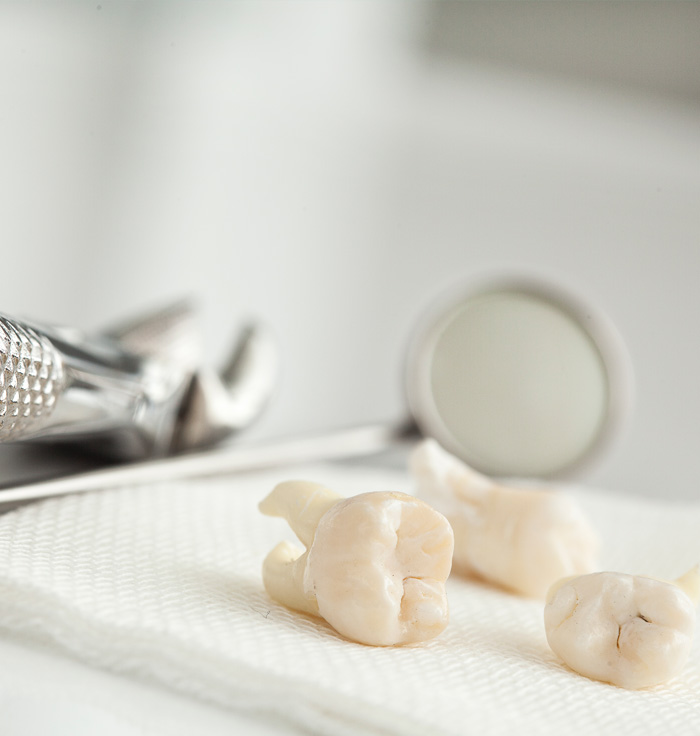 Dental tools and extracted teeth on a white paper towel.