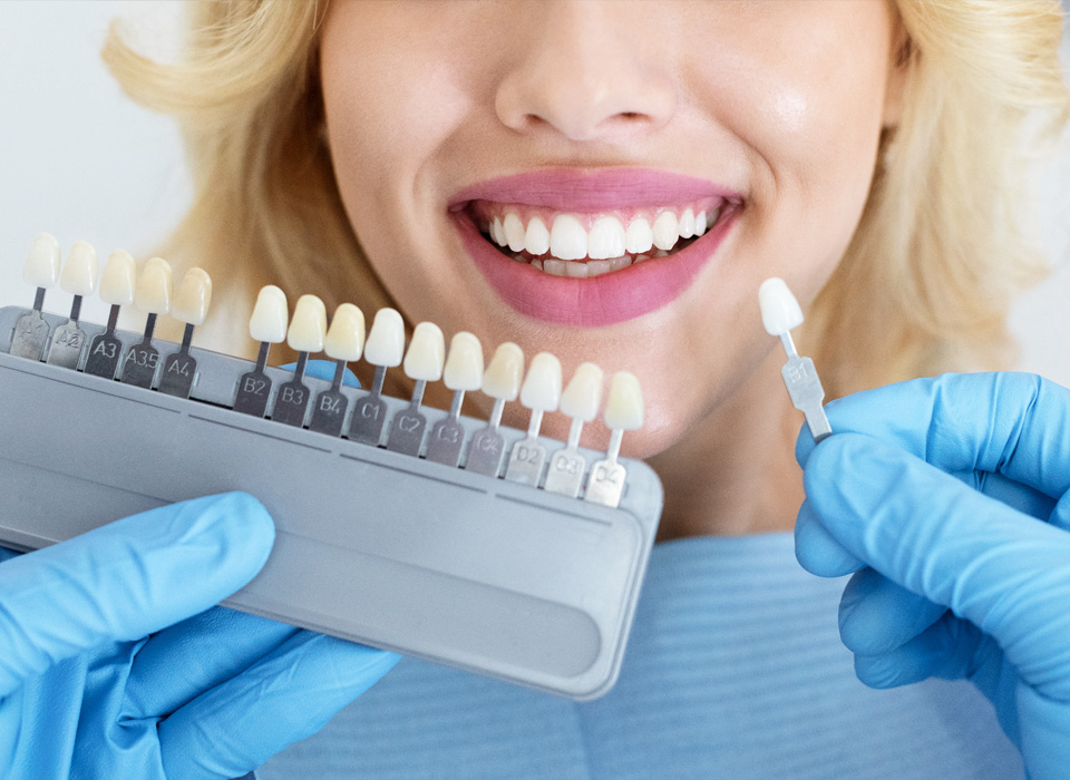 Teeth whitening shade chart being used to compare a patient's teeth to various shades.