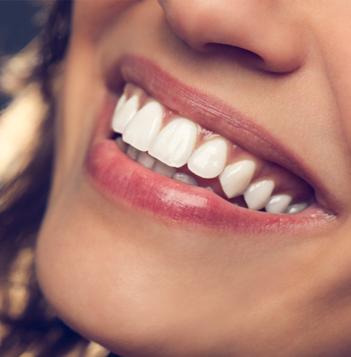 Close-up of a person's mouth showing a bright, healthy smile with even, white teeth.