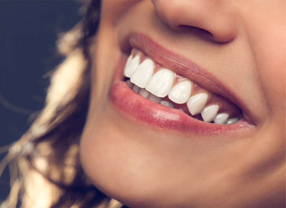 Close-up of a person's mouth showing a bright, healthy smile with even, white teeth.