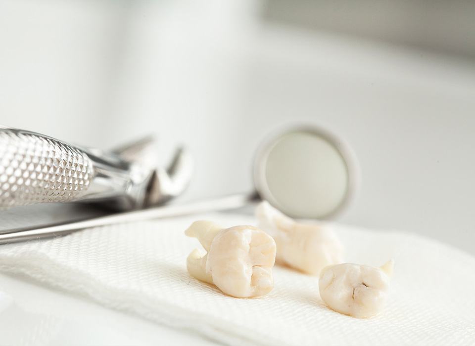 Dental tools and extracted teeth on a white paper towel.